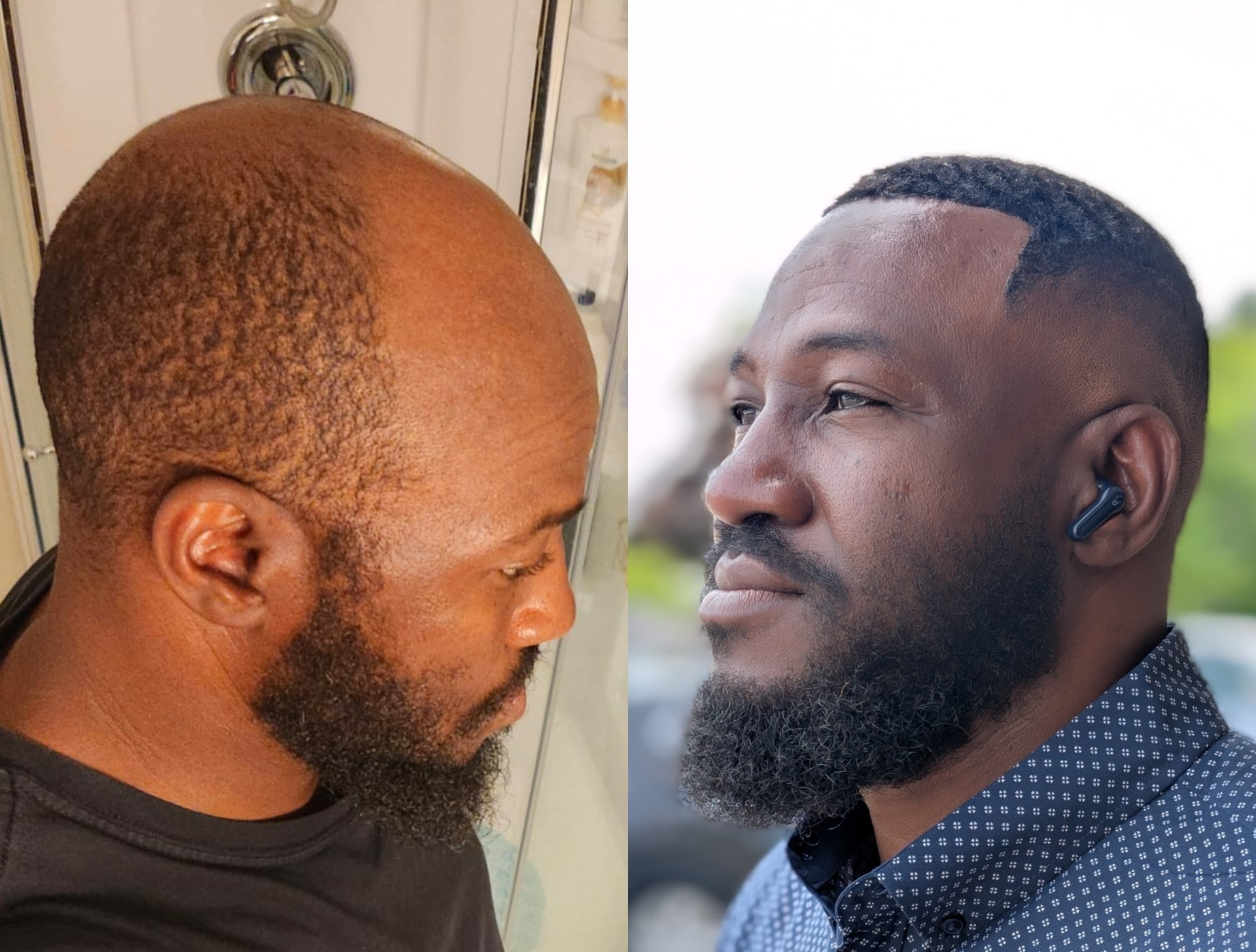 Hair unit transformation: before (left) and after (right)