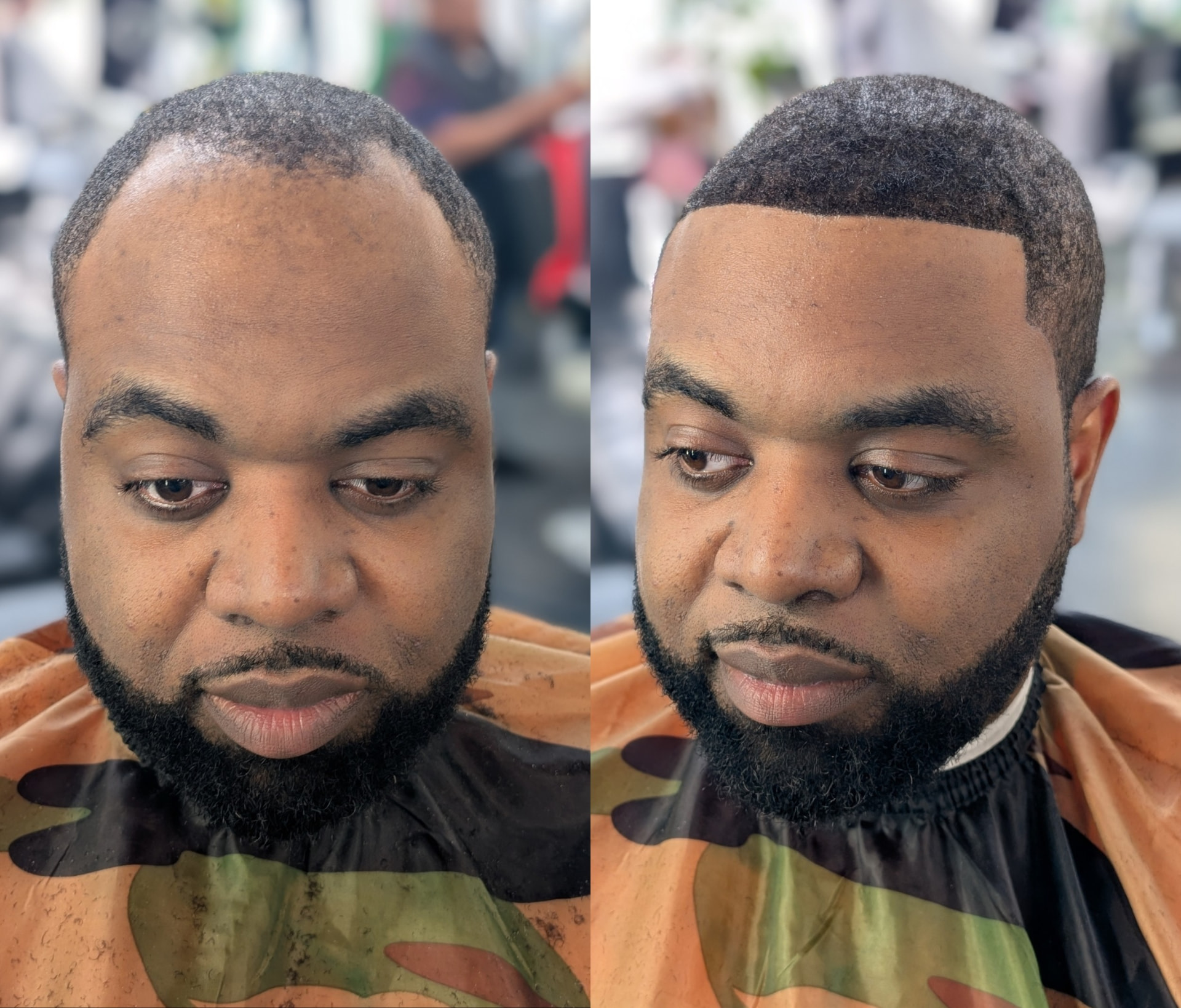 Hair unit transformation: before (left) and after (right)