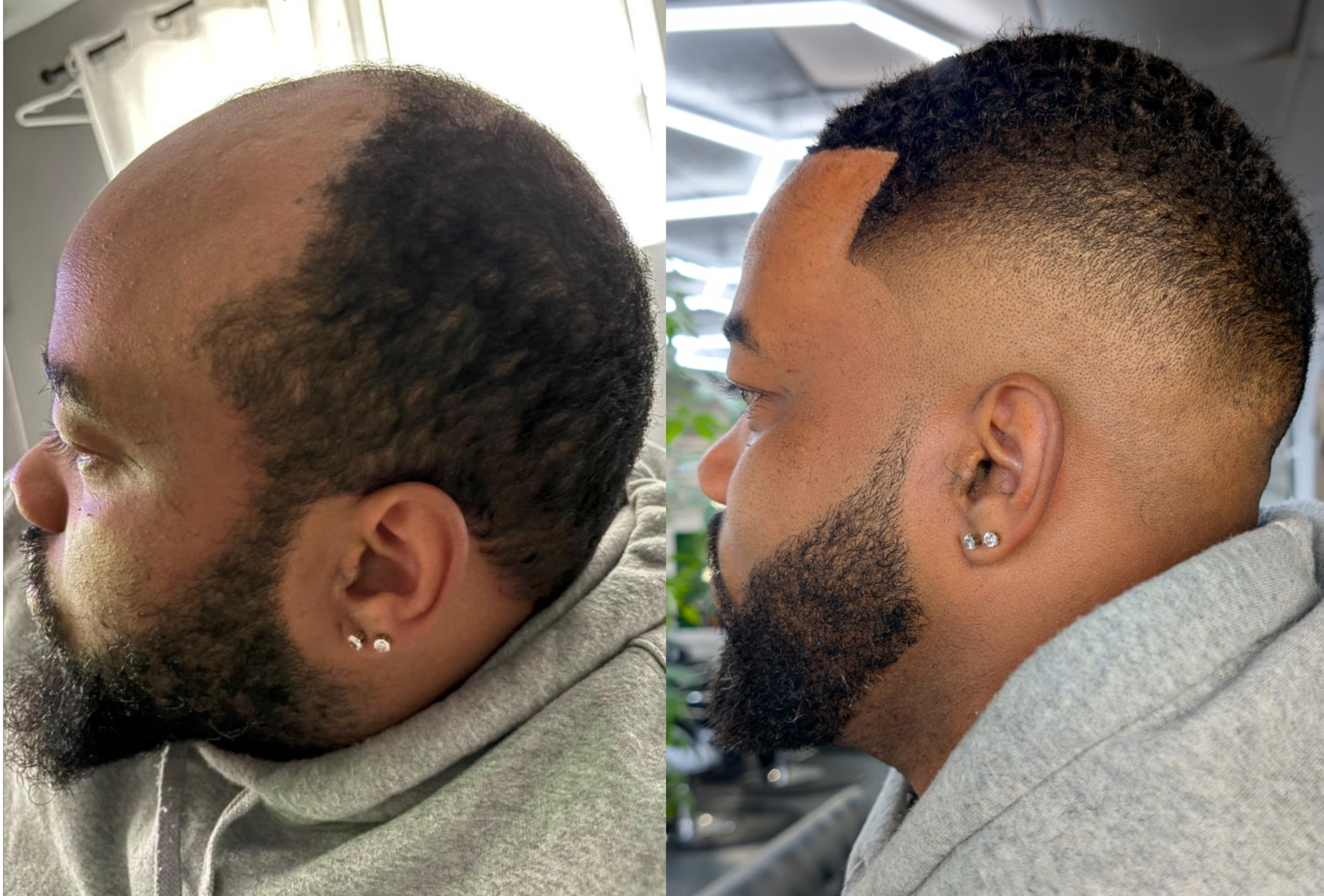Hair unit transformation: before (left) and after (right)
