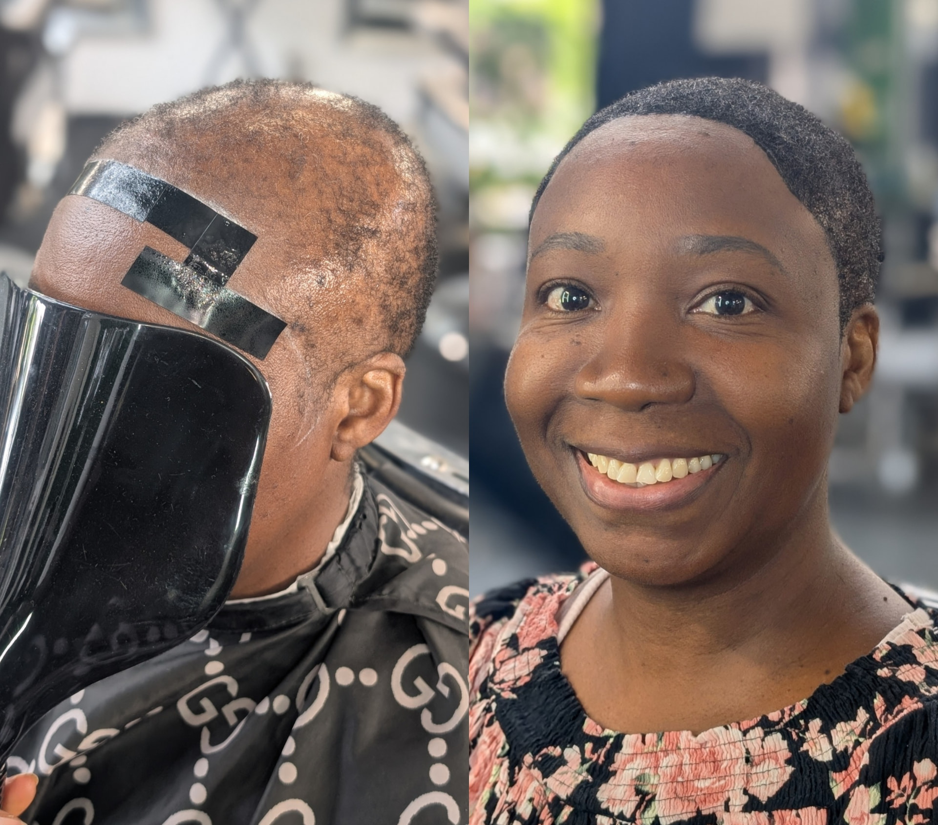 Hair unit transformation: before (left) and after (right)