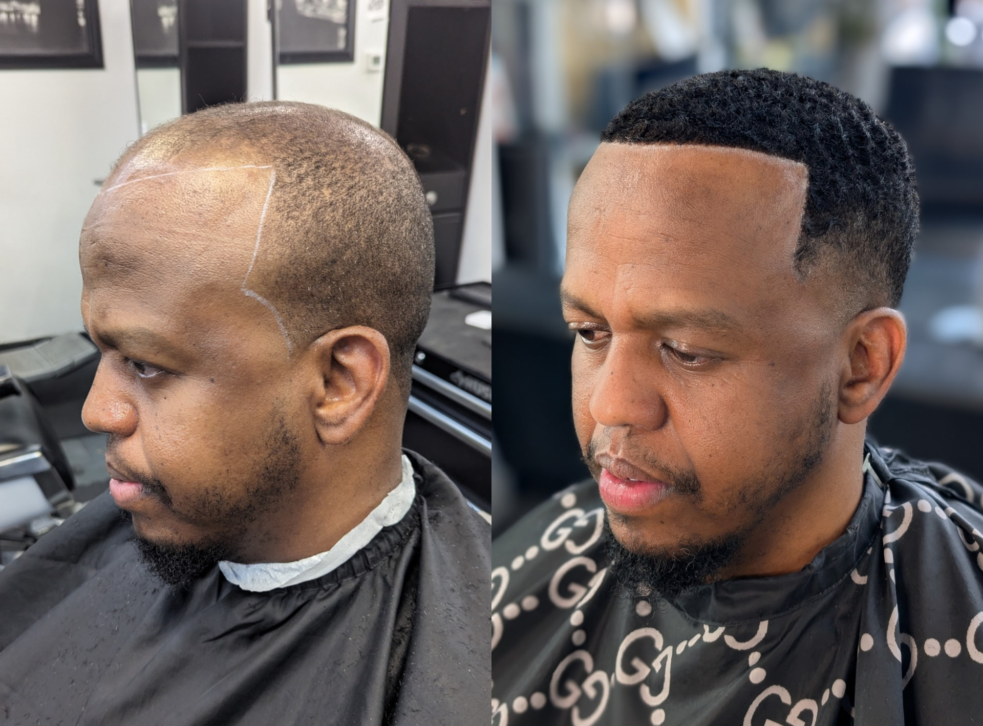 Hair unit transformation: before (left) and after (right)