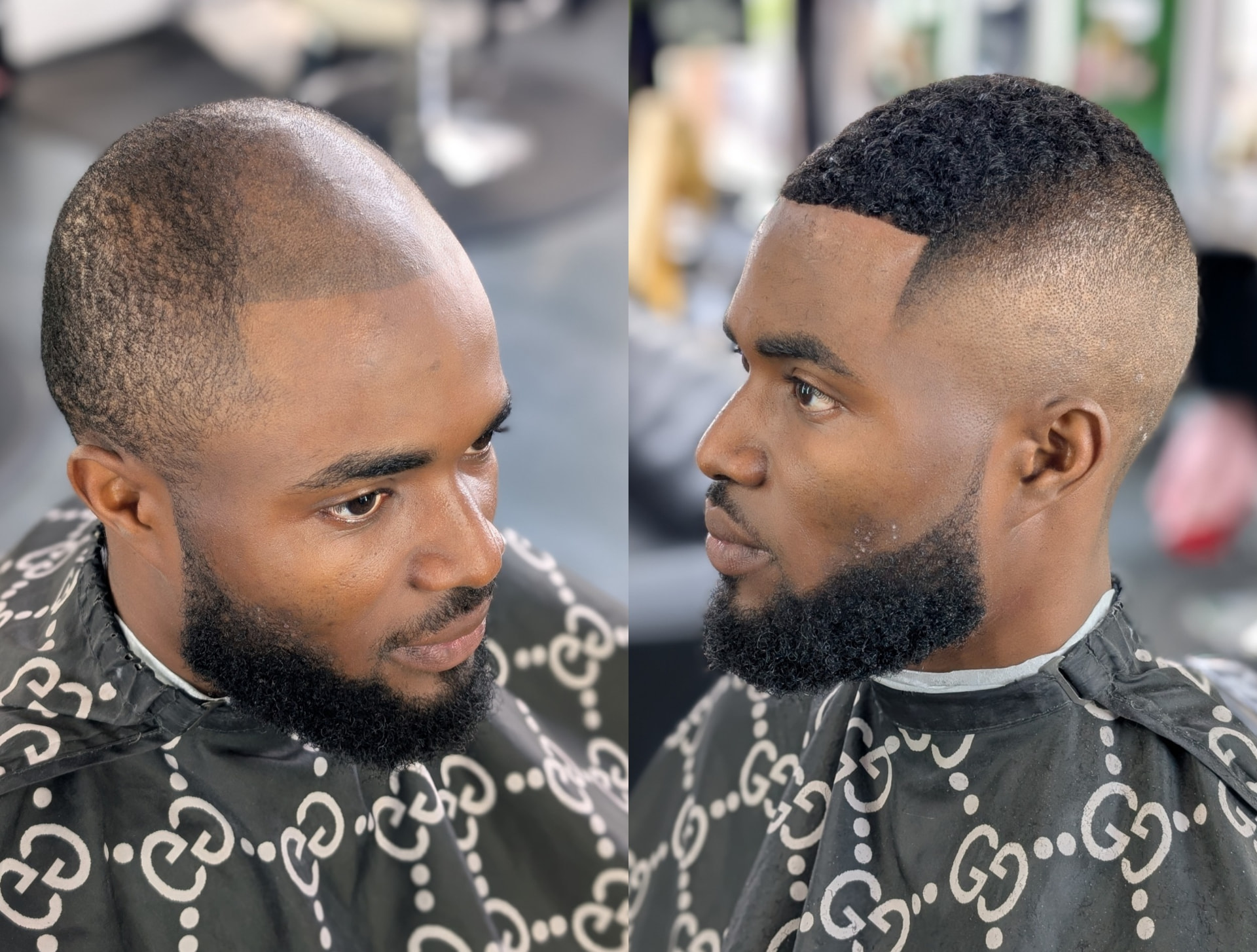 Hair unit transformation: before (left) and after (right)