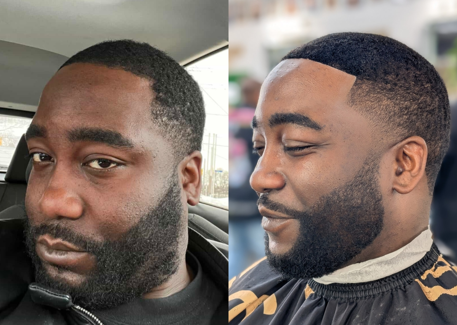 Hair unit transformation: before (left) and after (right)